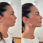 Viales para marcación 200€ 1 ml